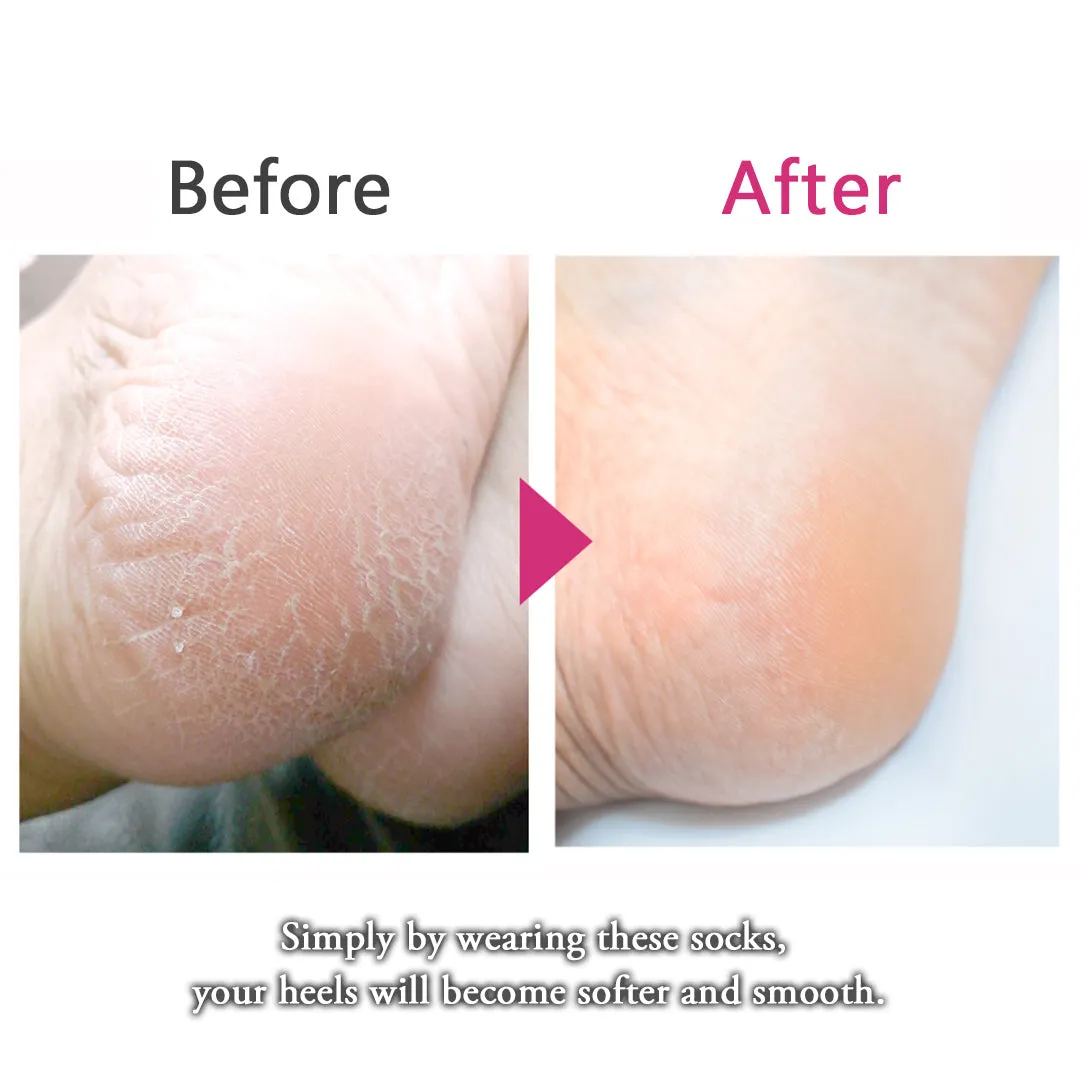 Loose-fitting heel-smoothing socks with elastic cuffs - 649